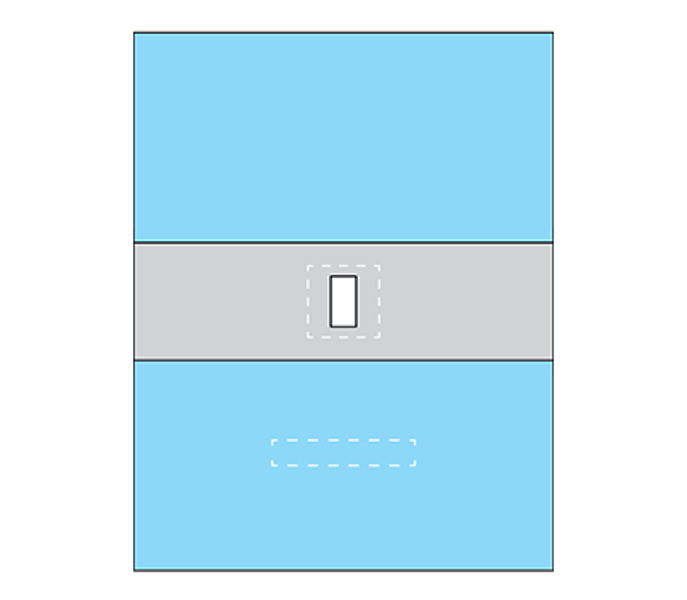 Clear Epidural Drape with Adhesive Aperture